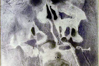 Iosias sepultus in mausoleum patrum (2 Chronicles 35:24)